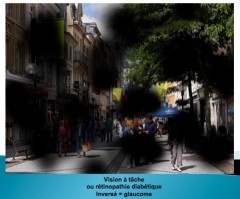 viiosn à tâches.jpg