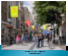 vision cataracte.jpg