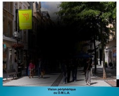vision périphérique.jpg